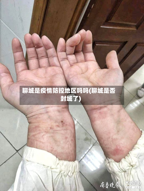 聊城是疫情防控地区吗吗(聊城是否封城了)